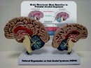 產婦酗酒對胎兒腦部影響的比較模型(歐美貨)