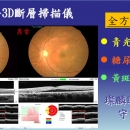 iVue眼科3D斷層掃描儀2