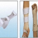 手腕骨折支架及固定支架